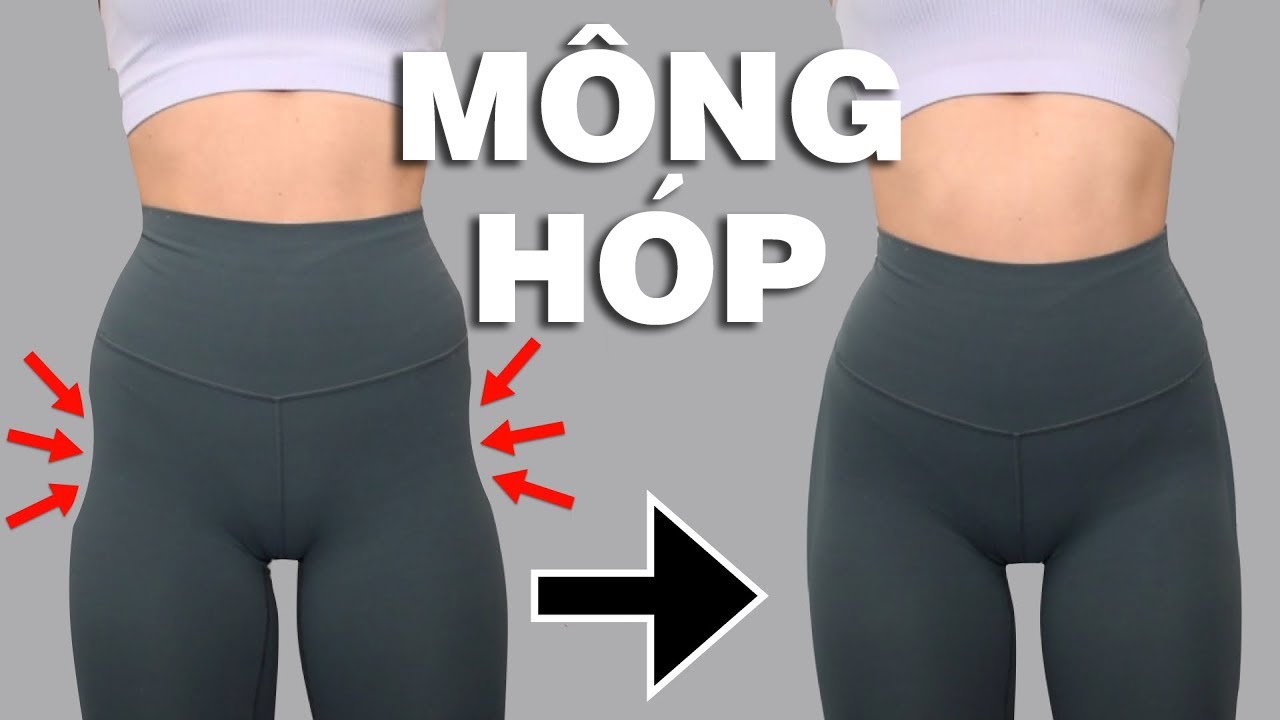 Mông Hóp 2 Bên: Nguyên Nhân, Cách Khắc Phục và Bài Tập Gallery 2