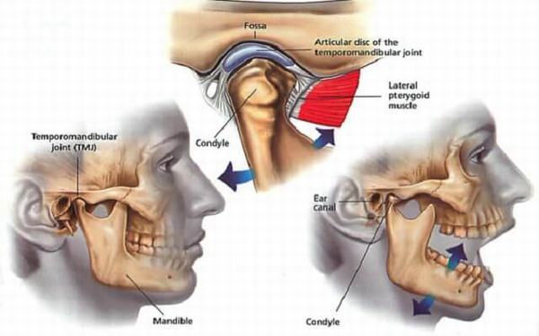 Ngáp Bị Đau Hàm: Nguyên Nhân Và Cách Khắc Phục Gallery 2