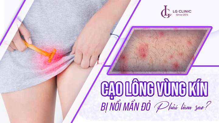 Vụng dại là gì? Gallery 2