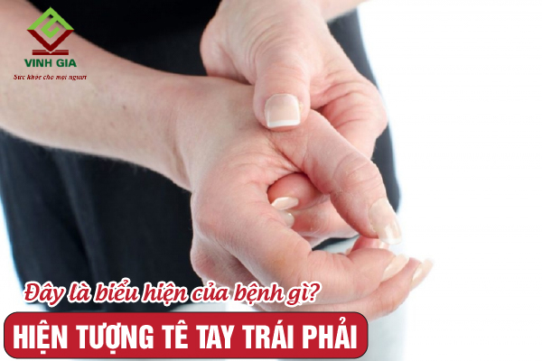 Tê Tay Trái: Nguyên Nhân và Cách Khắc Phục Gallery 2
