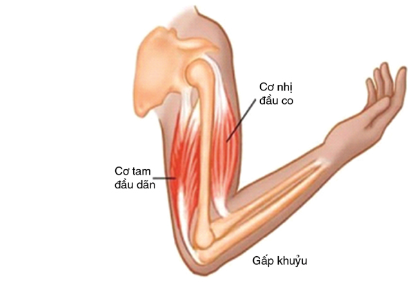 Cánh Tay Không Duỗi Thẳng Được: Nguyên Nhân và Cách Khắc Phục Gallery 2