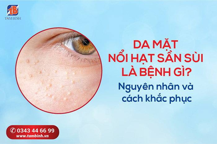Da Mặt Bé Bị Nổi Hạt Sần Sùi: Nguyên Nhân Và Cách Khắc Phục Gallery 2