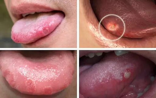 Lơ Là Là Gì? Gallery 2