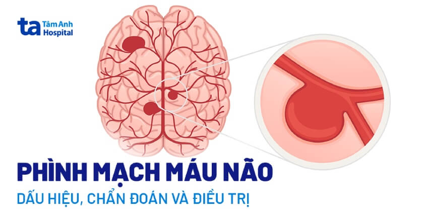 Não nề là gì? Gallery 2
