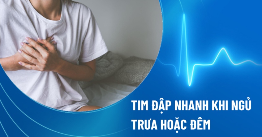 Ngủ trưa dậy tim đập nhanh: Nguyên nhân và cách khắc phục Gallery 2