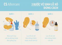 Xô sát là gì? Định nghĩa, nguyên nhân và cách khắc phục Gallery 2