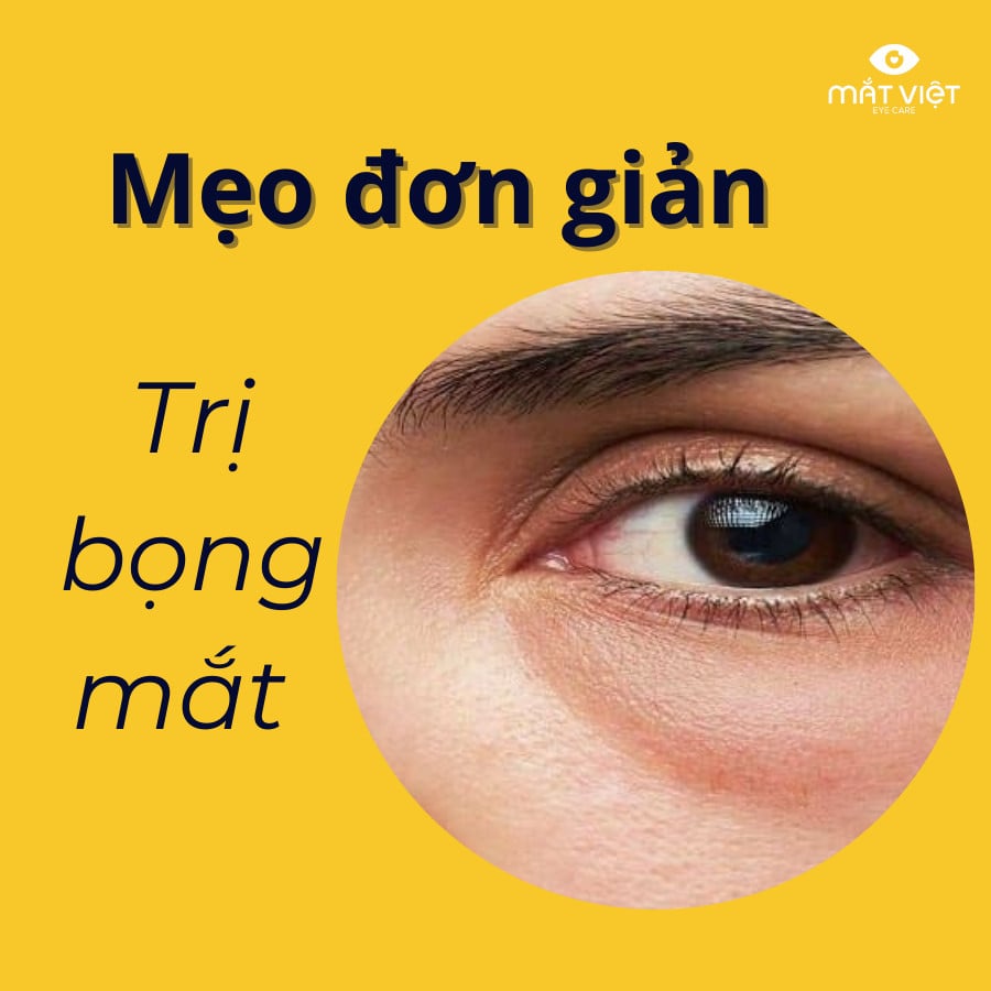 Cách Làm Bọng Mắt Nhỏ Lại Gallery 2