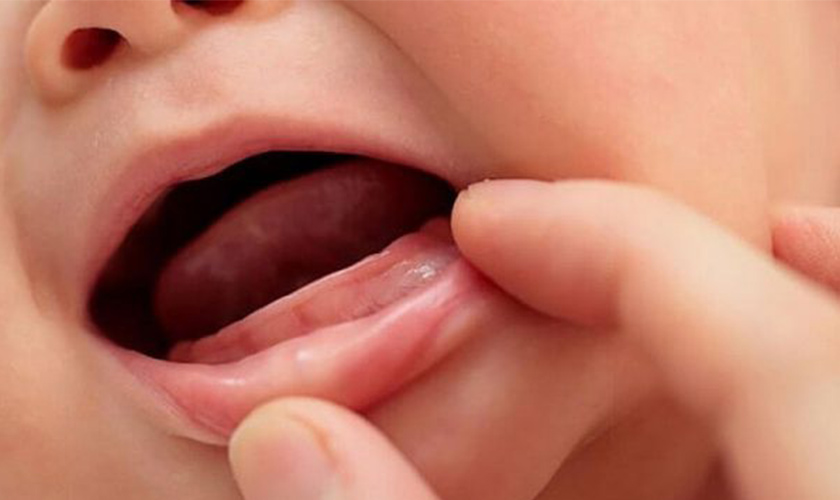 Cách Làm Cho Răng Mọc Nhanh Nhất