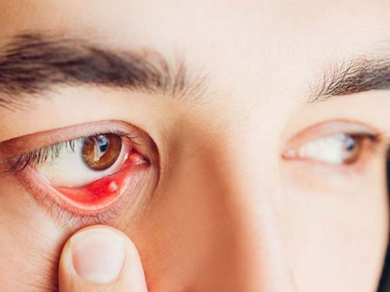 Cách Làm Hết Cộm Mắt