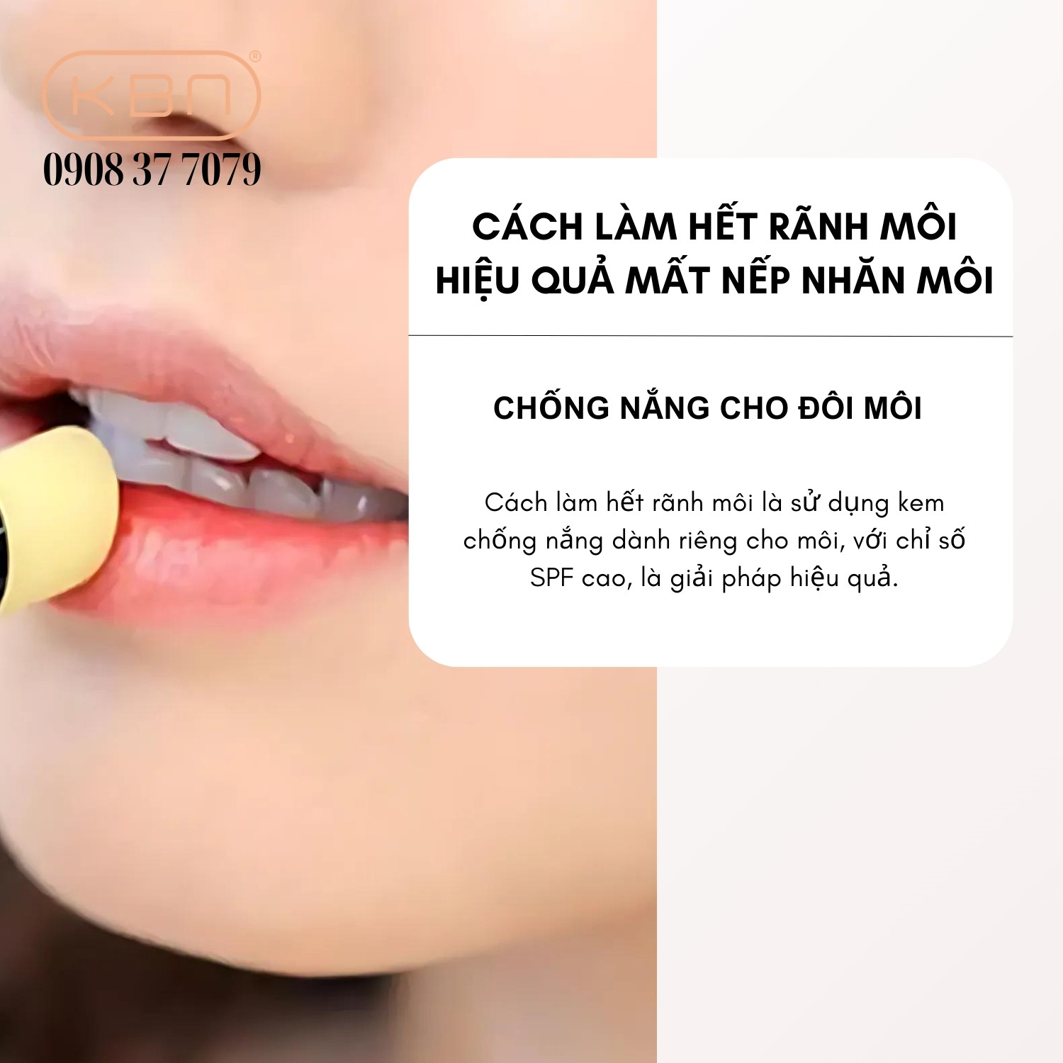 Cách Làm Hết Rãnh Môi