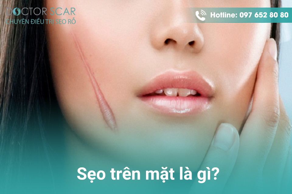 Cách Làm Liền Sẹo Trên Mặt Hiệu Quả Gallery 2