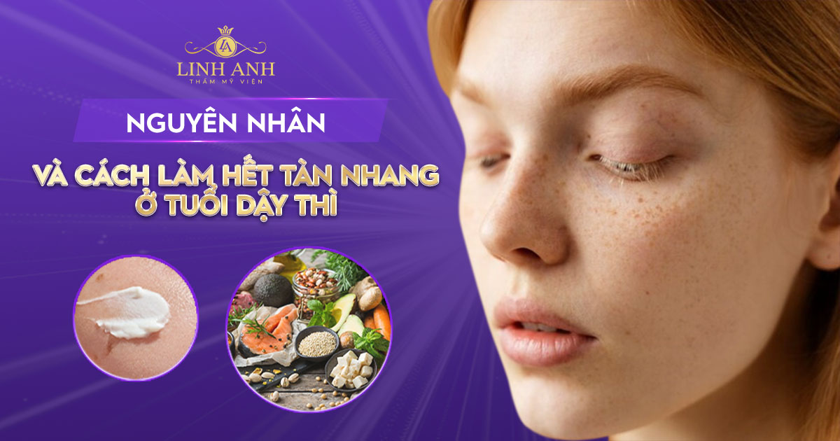 Cách Làm Hết Tàn Nhang Ở Tuổi Dậy Thì Gallery 2