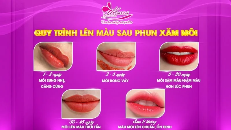 Cách Làm Nhạt Màu Môi Xăm