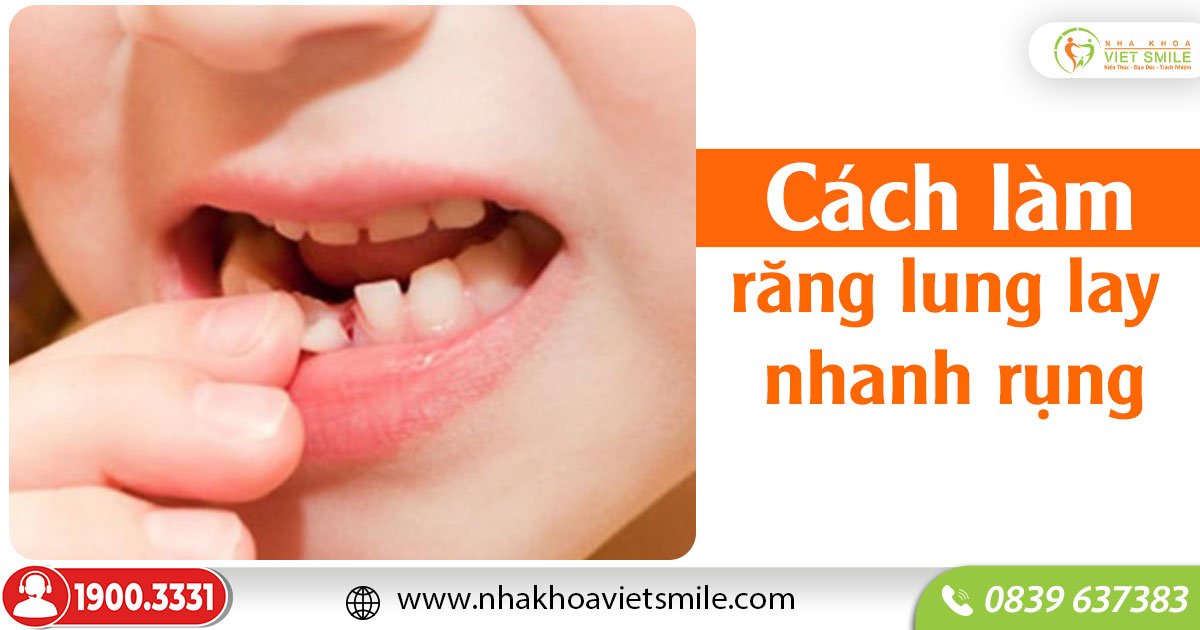Cách Làm Răng Lung Lay Nhanh Rụng