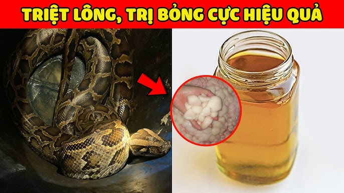 Cách Lấy Mỡ Trăn Hiệu Quả Và An Toàn Gallery 2