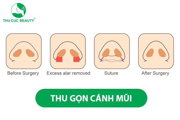 Cách Ngoáy Mũi Không Bị To