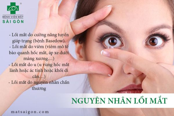 Cách Nhận Biết Mắt Bị Lồi Gallery 2