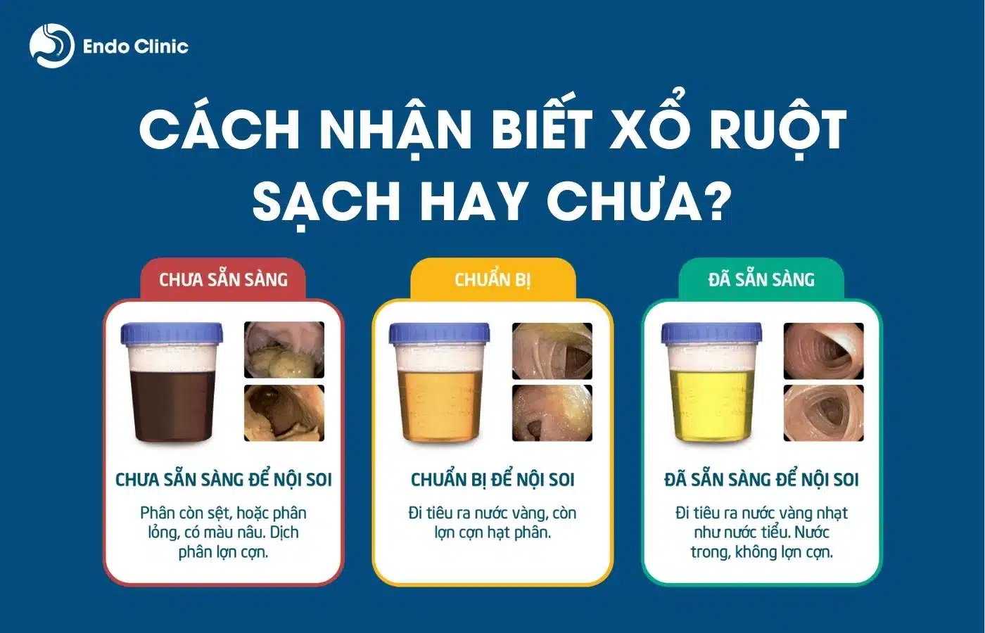 Xổ số xàng là gì? Hướng dẫn chơi và những điều cần biết Gallery 2