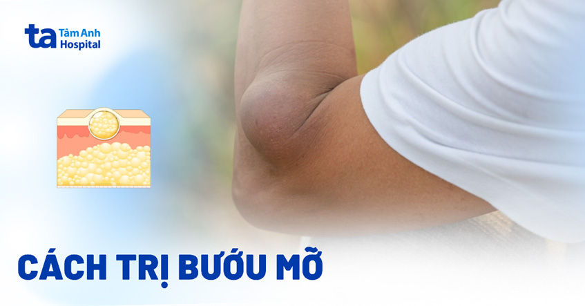 Dửng mỡ là gì? Gallery 2