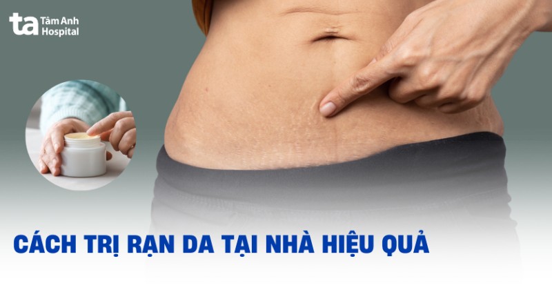 Mạnh Rạn Là Gì? Định Nghĩa, Đặc Điểm Và Cách Rèn Luyện Gallery 2