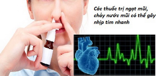 Thuốc Chống Ngạt Mũi: Giải Pháp Hiệu Quả Cho Mũi Bị Nghẹt Gallery 2