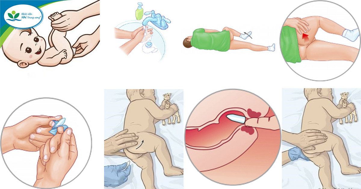 Cách Sử Dụng Thuốc Nhét Hậu Môn Cho Trẻ