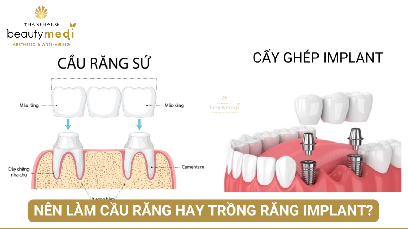 Làm Lên Hay Làm Nên? Gallery 2
