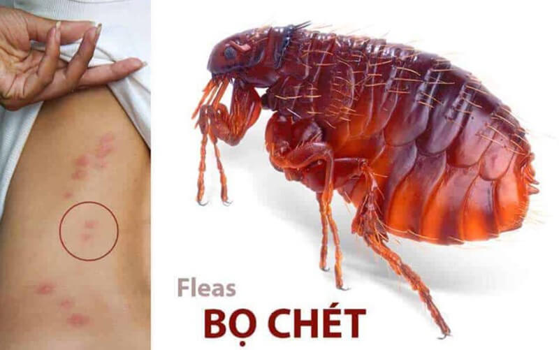 Cách Trị Bọ Chó Đốt Người