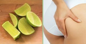 Trị Mông Sần Sùi Hiệu Quả Tại Nhà & Tại Spa Gallery 2