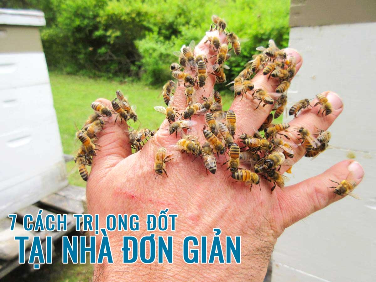 Cách Trị Ong Đốt Bị Sưng