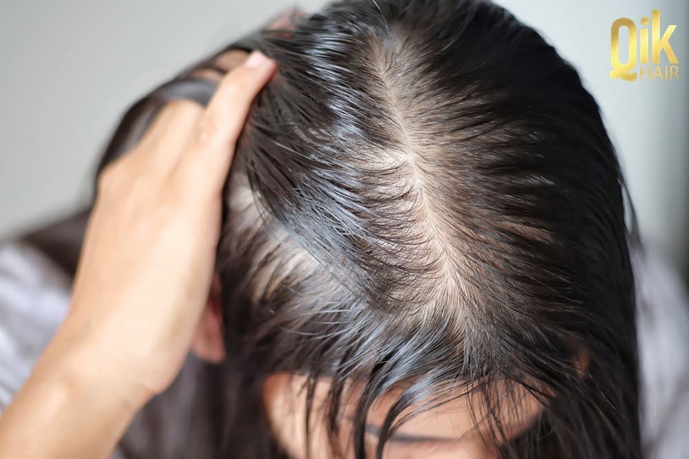Cách Trị Tóc Mỏng Và Thưa Tại Nhà