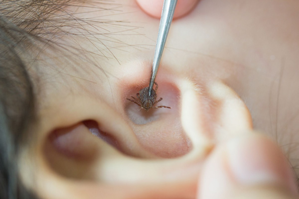 Cách Trị Ve Chó Trong Lỗ Tai Chó