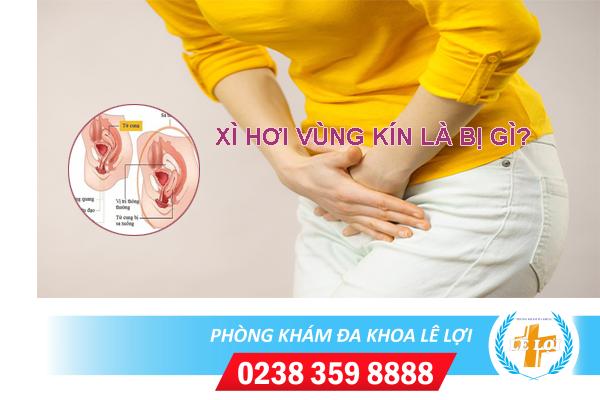 Cách Trị Xì Hơi Vùng Kín