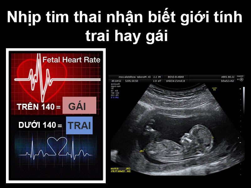 Mang thai không nghén là trai hay gái? Gallery 2