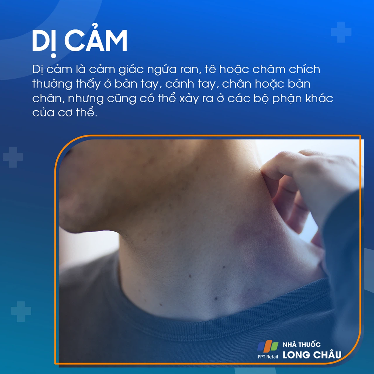 Cảm giác rần rần trên mặt là gì? Nguyên nhân và cách xử lý Gallery 2