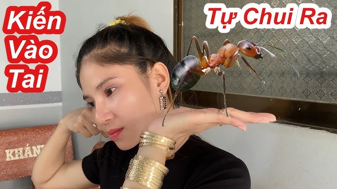Kiến bò vào tai: Nguyên nhân, cách xử lý và phòng ngừa Gallery 2