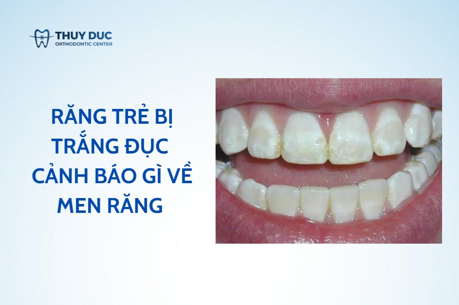 Răng Trẻ Bị Trắng Đục: Nguyên Nhân và Cách Xử Lý Gallery 2