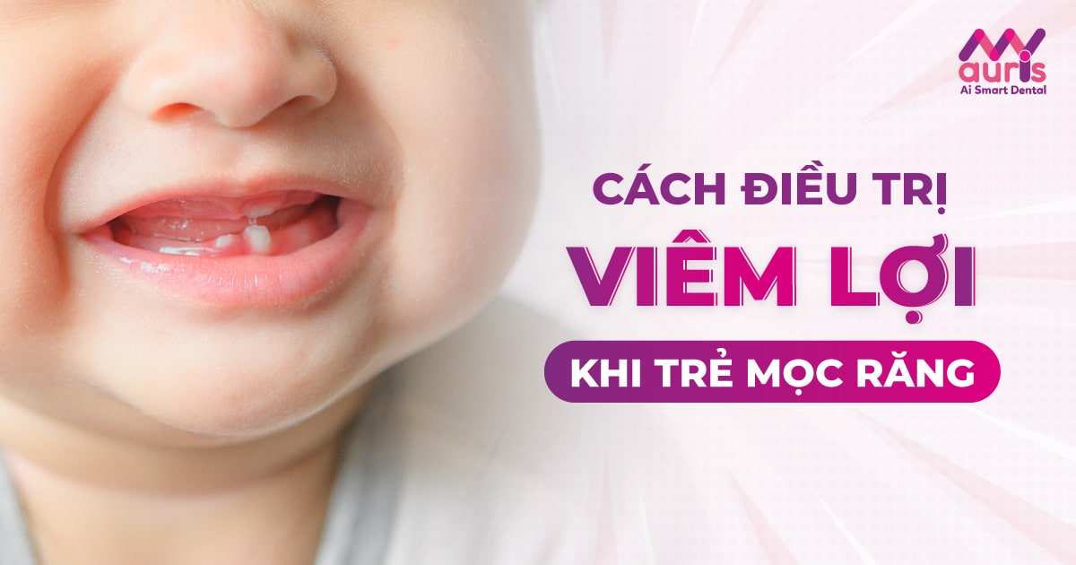 Trẻ mọc răng bị tím lợi: Nguyên nhân và cách xử lý Gallery 2