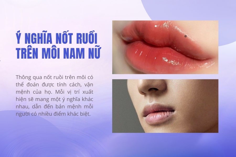 Mụn Ruồi Ở Môi Trên: Nguyên Nhân, Cách Xử Lý và Điều Cần Lưu Ý Gallery 2