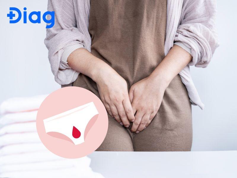 Vùng kín ẩm ướt trước kỳ kinh: Nguyên nhân và cách xử lý Gallery 2
