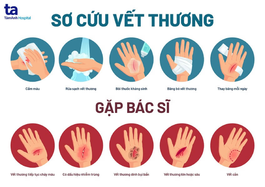 Vết Thương Sâu Hở Miệng: Nguyên Nhân, Cách Xử Trí Và Phòng Ngừa Gallery 2