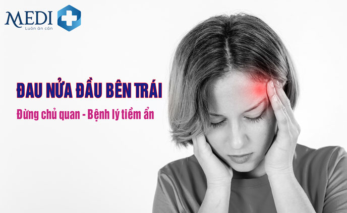 Đau Nửa Đầu Bên Trái Gallery 2