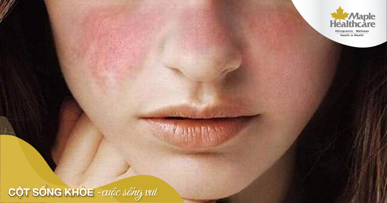 Cảm giác rần rần trên mặt là gì? Nguyên nhân và cách xử lý