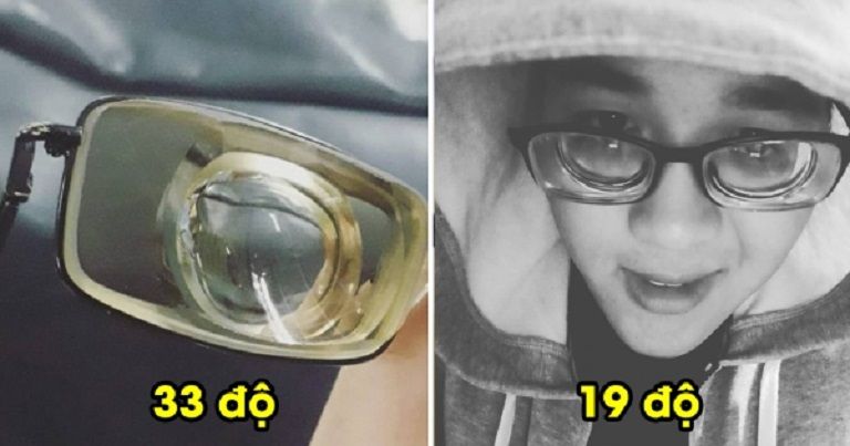 Cận Bao Nhiêu Độ Là Mù? Gallery 2