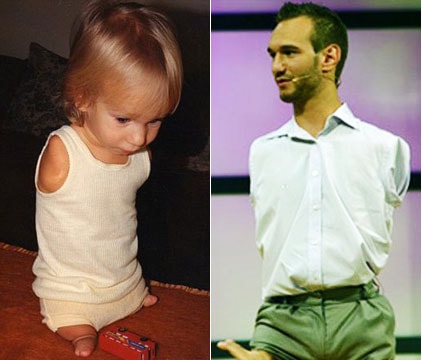 Câu chuyện truyền cảm hứng của Nick Vujicic
