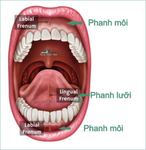 Phanh môi là gì? Gallery 1
