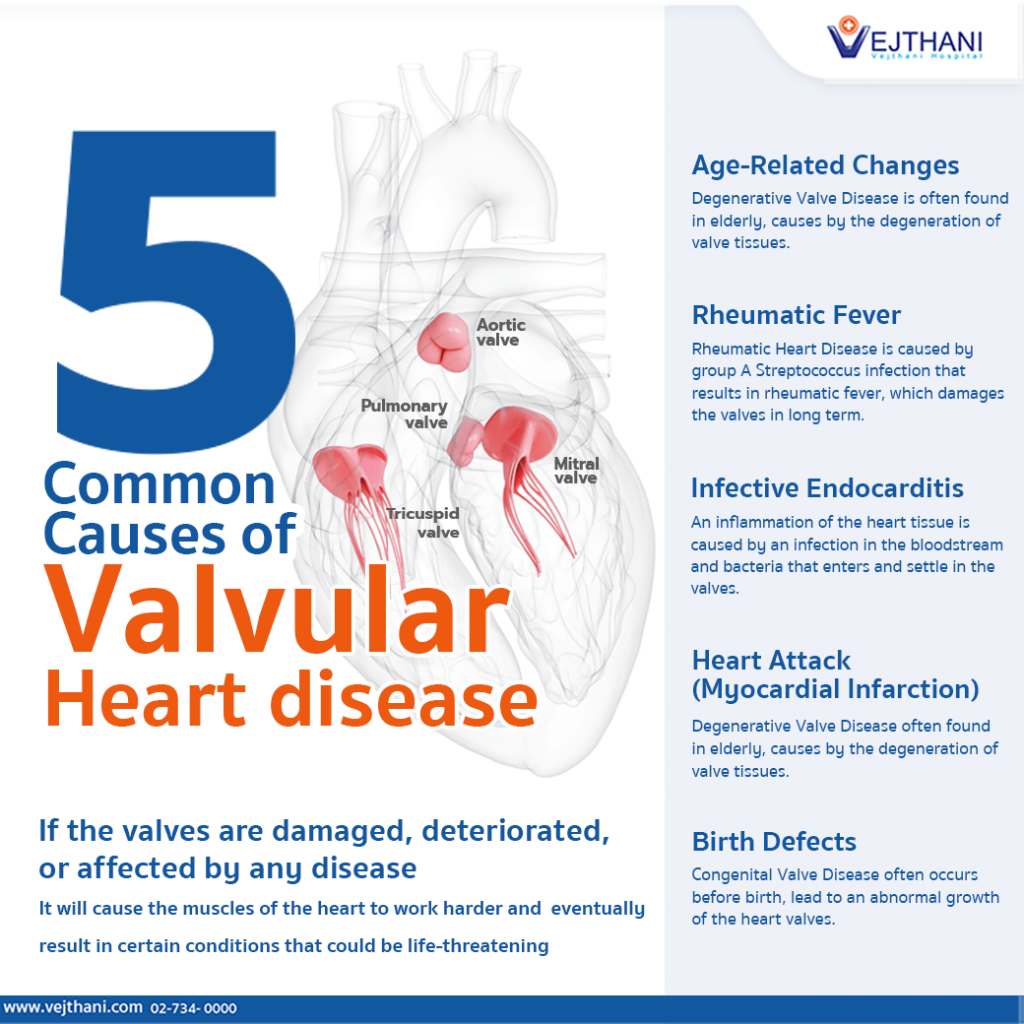 Heart Valve Disease Gallery 2