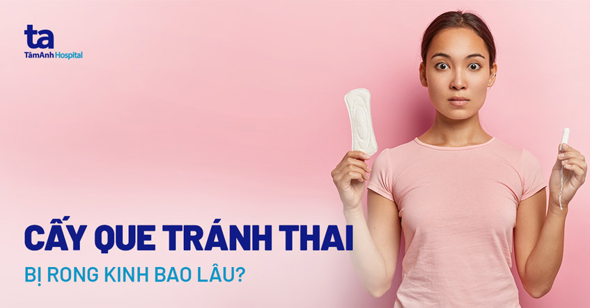 Cấy que bị rong kinh bao lâu?