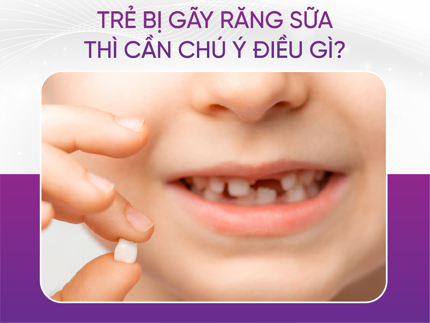 Trẻ bị gãy răng sữa có mọc lại không? Gallery 2