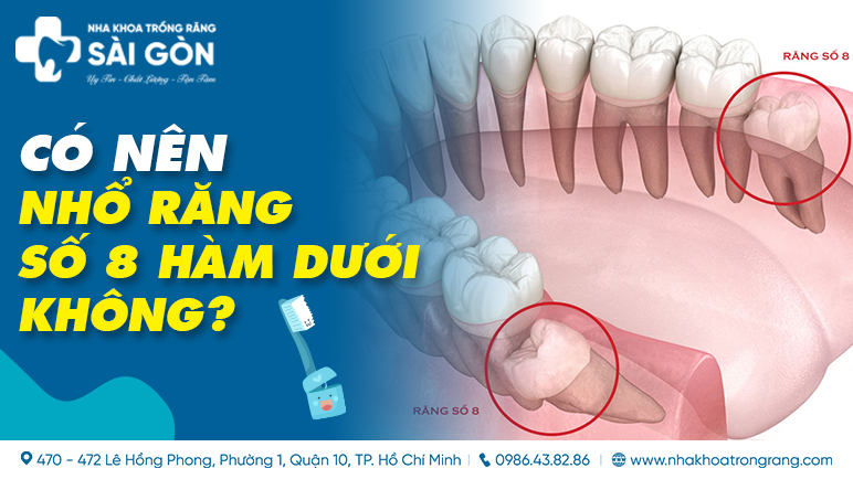 Nhổ Răng Số 8 Hàm Dưới Gallery 2